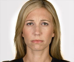 Tina 7 days after
