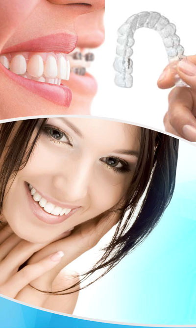 Invisalign braces from dentist in Sheffield