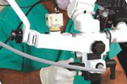 Root Canal