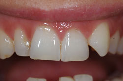 Before
